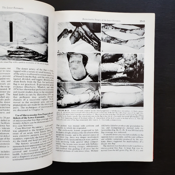 Vintage 1977 2nd Ed Reconstructive Plastic Surgery Vol 7 Medical Hardcover Book - Picture 5 of 8